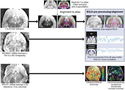 In utero methadone exposure permanently alters anatomical and functional connectivity: A preclinical evaluation